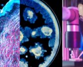 Strateško partnerstvo L’ORÉAL Grupe i Pasterovog instituta